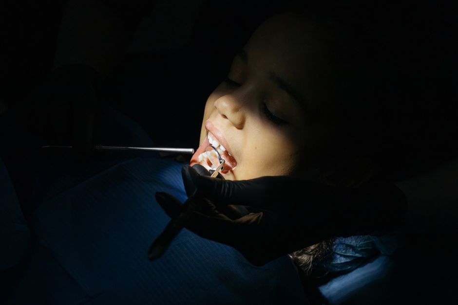 Pedodonție — cei mici la dentist